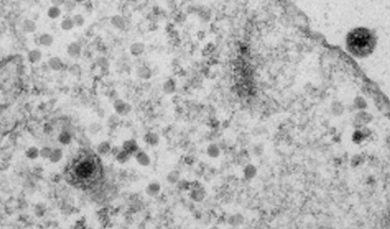 BRASIL: DESCUBREN EL YARAVIRUS, UN MISTERIOSO VIRUS QUE INTRIGA A LOS CIENTÍFICOS