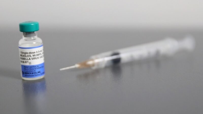 SUMAN 81 CASOS CONFIRMADOS DE SARAMPIÓN EN MÉXICO