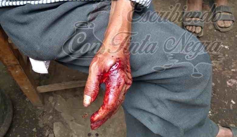 LE ROBAN SU CAFÉ Y LO MACHETEAN