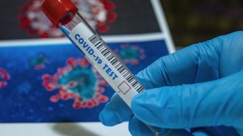 AMLO, ALCOCER Y LÓPEZ-GATELL NO SE HAN HECHO PRUEBAS DE CORONAVIRUS EN LO QUE VA DE LA PANDEMIA