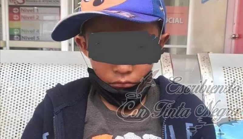 ATACA PITBULL A NIÑO QUE VENDÍA EN LA CALLE