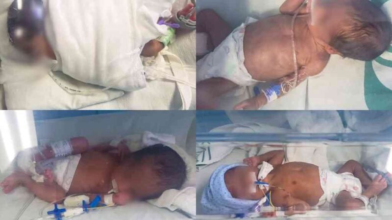 NACEN ¡CUATRILLIZOS! EN EL IMSS