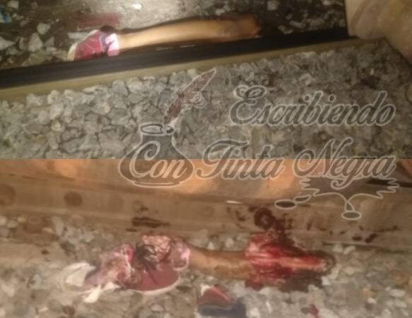 PIERDE LAS PIERNAS EN BUSCA DEL “SUEÑO AMERICANO”