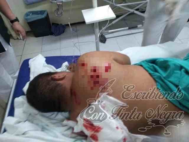 LO BALEAN Y SOBREVIVE