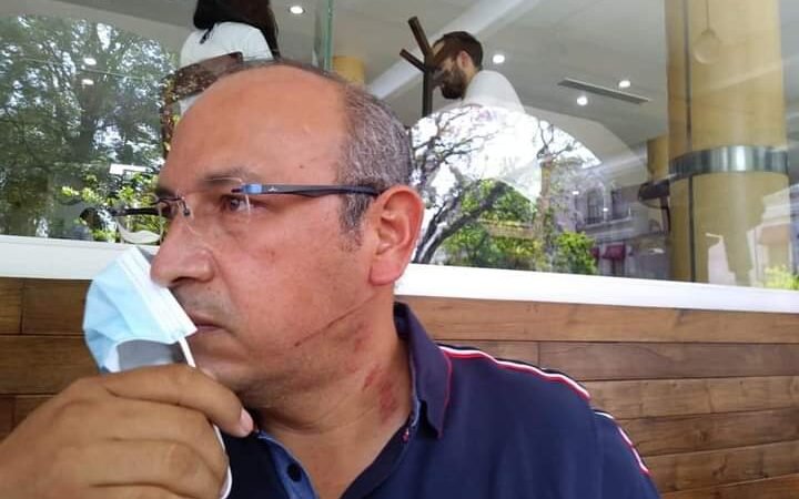 GOLPEAN Y DESPOJAN DE CAMIONETA A CANDIDATO DEL MORENA