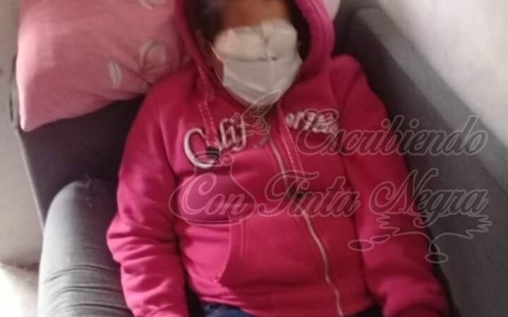 LE ECHAN ÁCIDO EN LOS OJOS