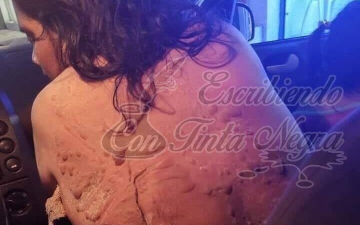 LE ARROJA ACEITE HIRVIENDO A SU PAREJA