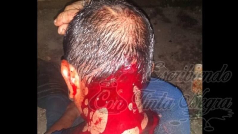 MACHETEAN A CAMPESINO DE COMAPA