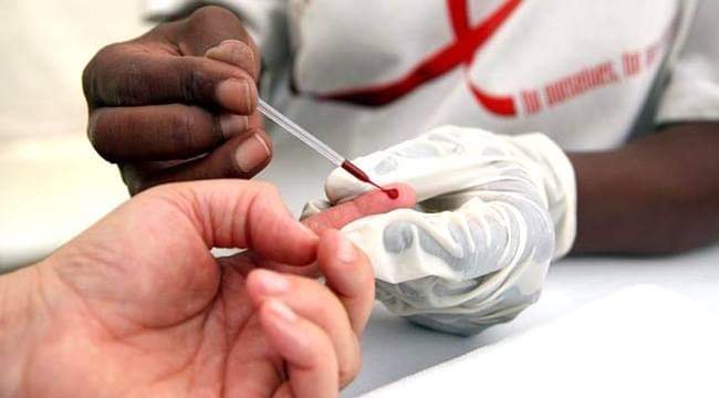 SE DISPARAN CASOS DE SIDA EN EL ESTADO