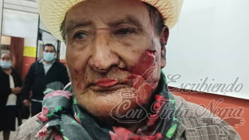 ATACAN A SENECTO; EXIGEN JUSTICIA