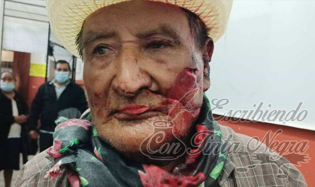 ATACAN A SENECTO; EXIGEN JUSTICIA