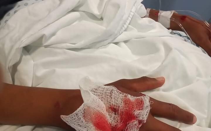 CAMINOS EN MAL ESTADO PROVOCAN ACCIDENTES EN CHOCAMÁN