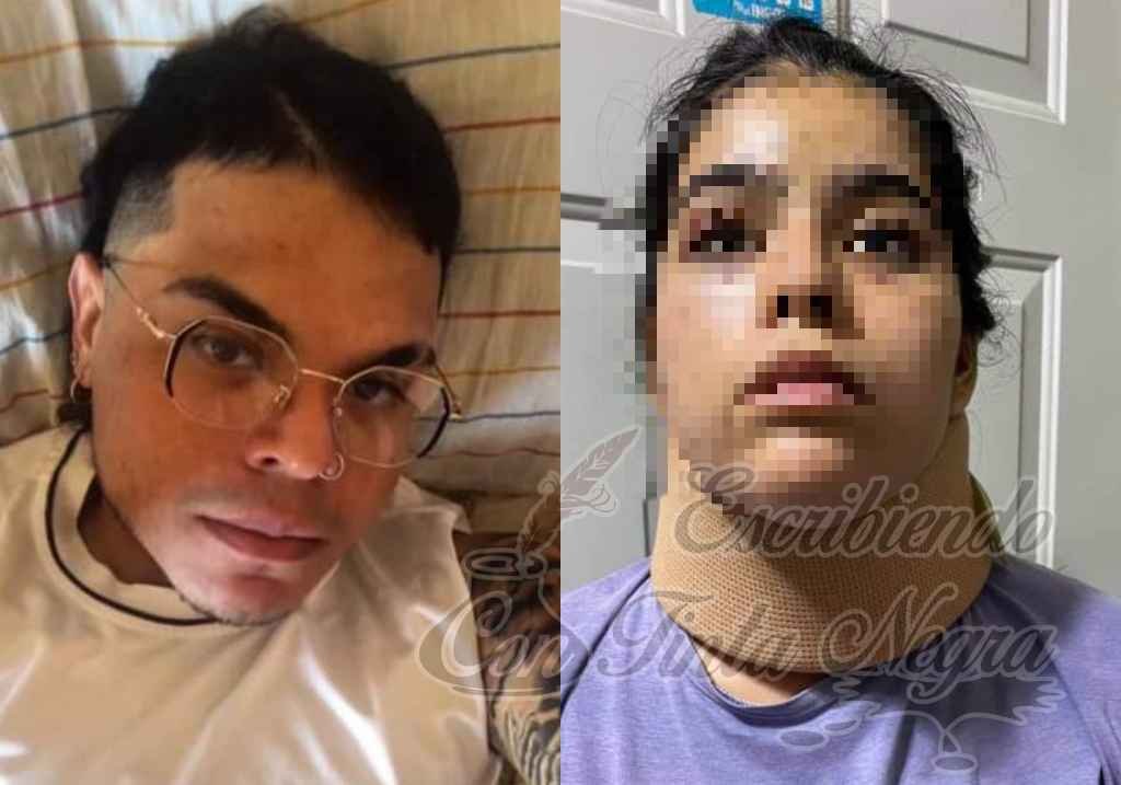 INTENTÓ MATAR A SU PAREJA; LO BOLETINAN