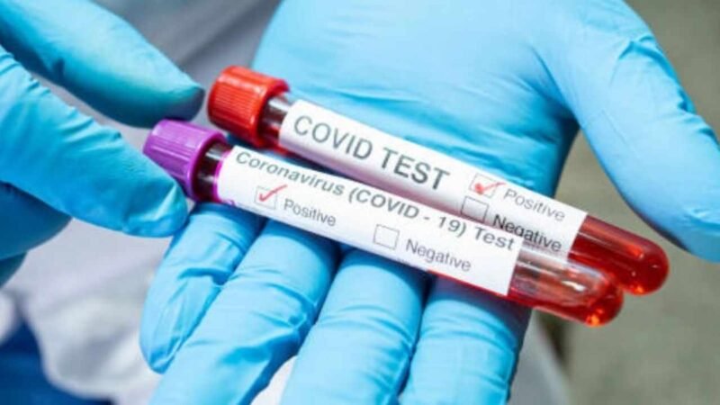 DETECTAN VARIANTES DELTA Y MU DE COVID-19 EN UN MISMO PACIENTE