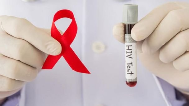DETECTAN A VB, UN TIPO DE VIH MÁS CONTAGIOSO