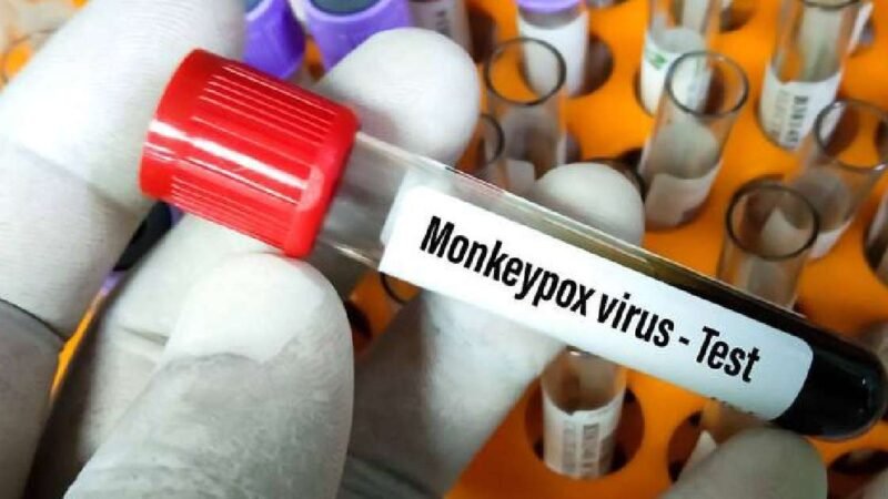 VENEZUELA DETECTA SU PRIMER CASO DE VIRUELA DEL MONO