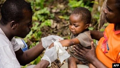 ÁFRICA SE DECLARA EN EMERGENCIA POR VIRUELA DEL MONO