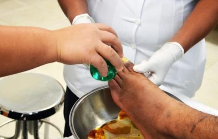 EXHORTA IMSS VERACRUZ A DIABÉTICOS EXTREMAR CUIDADO DE LOS PIES PARA EVITAR SU PÉRDIDA
