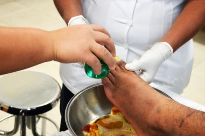EXHORTA IMSS VERACRUZ A DIABÉTICOS EXTREMAR CUIDADO DE LOS PIES PARA EVITAR SU PÉRDIDA