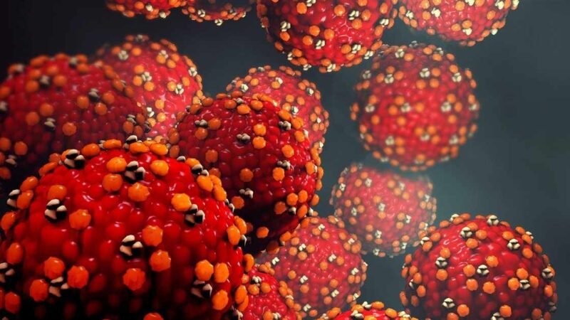 ESPAÑA SE ACERCA A LOS 3 MIL CASOS DE VIRUELA DEL MONO