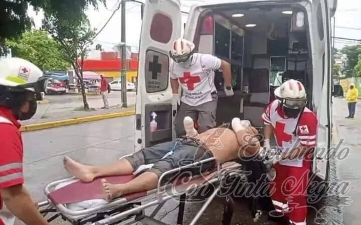 LE AMPUTAN LAS MANOS POR LADRÓN