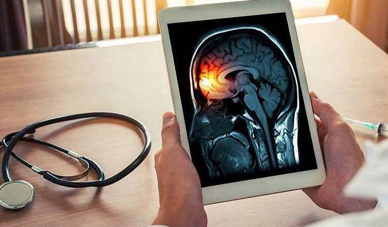 AUMENTAN LOS CASOS DE MENINGITIS EN DURANGO