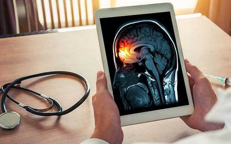 AUMENTAN LOS CASOS DE MENINGITIS EN DURANGO