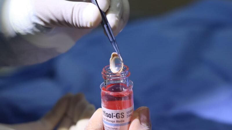 SUMA IMSS 12 DONACIONES DE CORNEAS