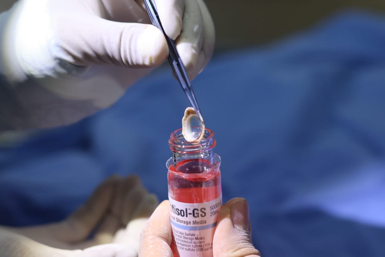 RECIBE IMSS VERACRUZ SUR DONACIÓN DE CÓRNEAS