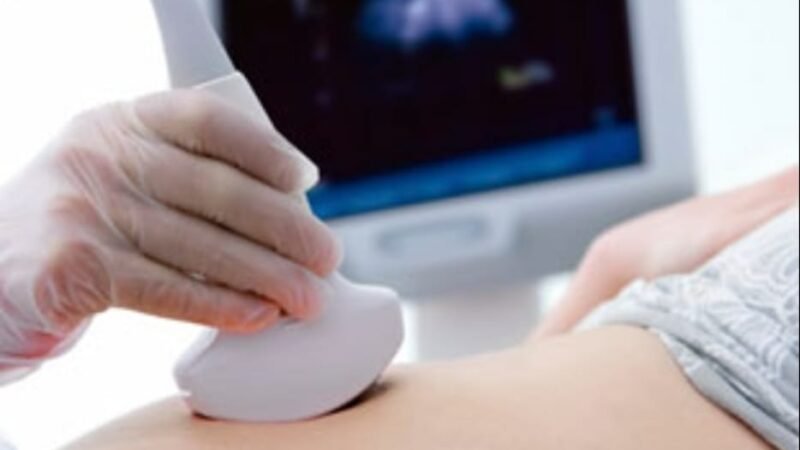 IMSS EXHORTA A EMBARAZADAS A LLEVAR CONTROL PRENATAL PARA EVITAR PREECLAMPSIA