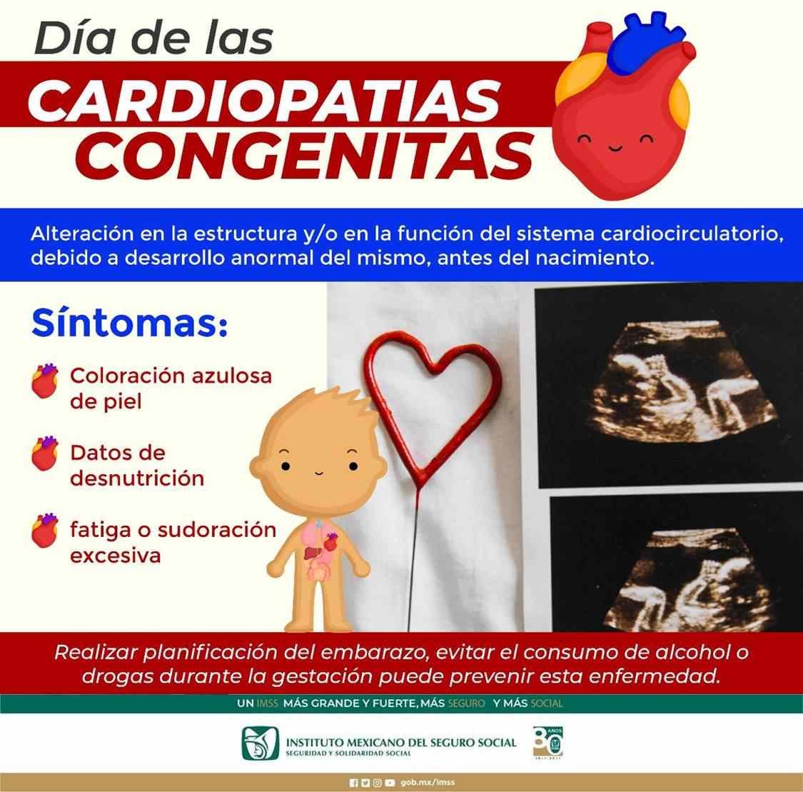 EXHORTA IMSS A ATENDER CARDIOPATÍAS CONGÉNITAS PARA MEJORAR CONDICIONES DE VIDA