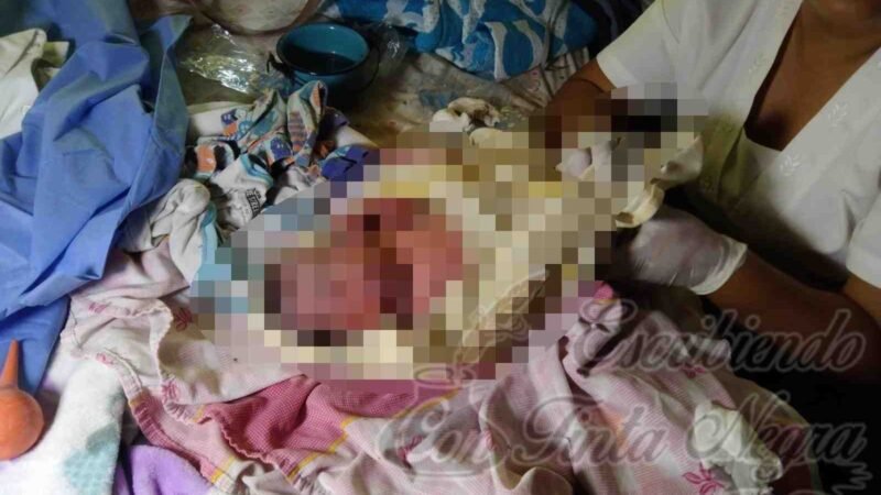 ABANDONAN A RECIÉN NACIDO EN CANAL DE AGUAS NEGRAS