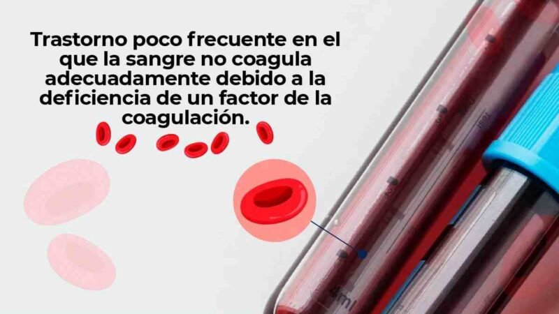 FALTA DE COAGULACIÓN EN LA SANGRE, SEÑAL DE ALERTA DE HEMOFILIA