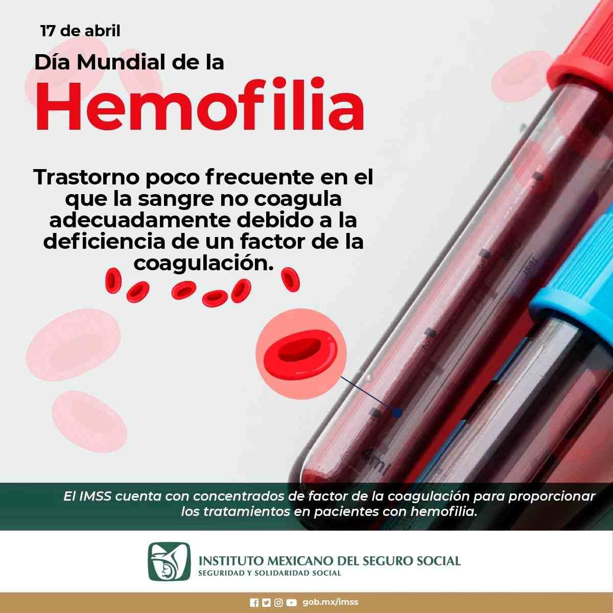 FALTA DE COAGULACIÓN EN LA SANGRE, SEÑAL DE ALERTA DE HEMOFILIA