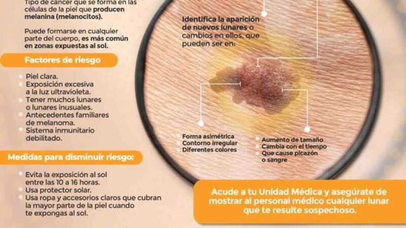 IMSS RECOMIENDA TOMAR PRECAUCIONES PARA EVITAR CÁNCER DE PIEL