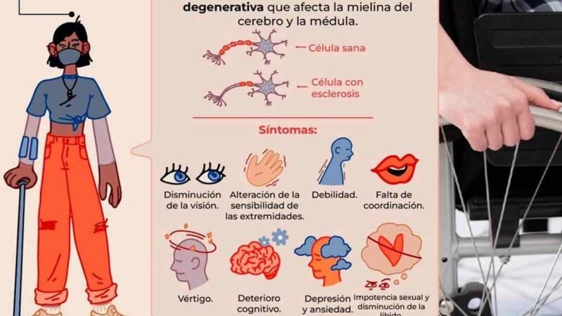ATACA ESCLEROSIS MÚLTIPLE A MUJERES