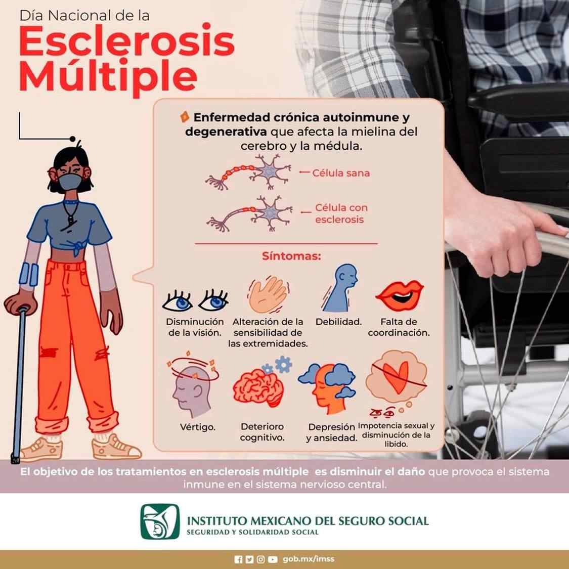ATACA ESCLEROSIS MÚLTIPLE A MUJERES