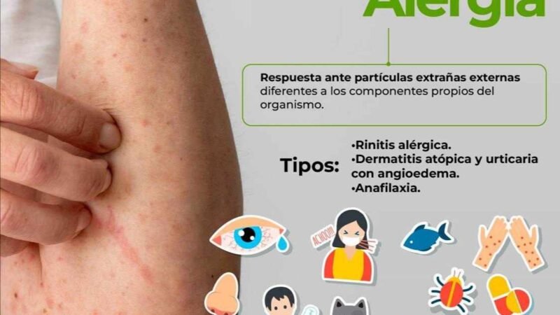 EXHORTA IMSS A CORRECTO CUIDADO DE ALERGIAS