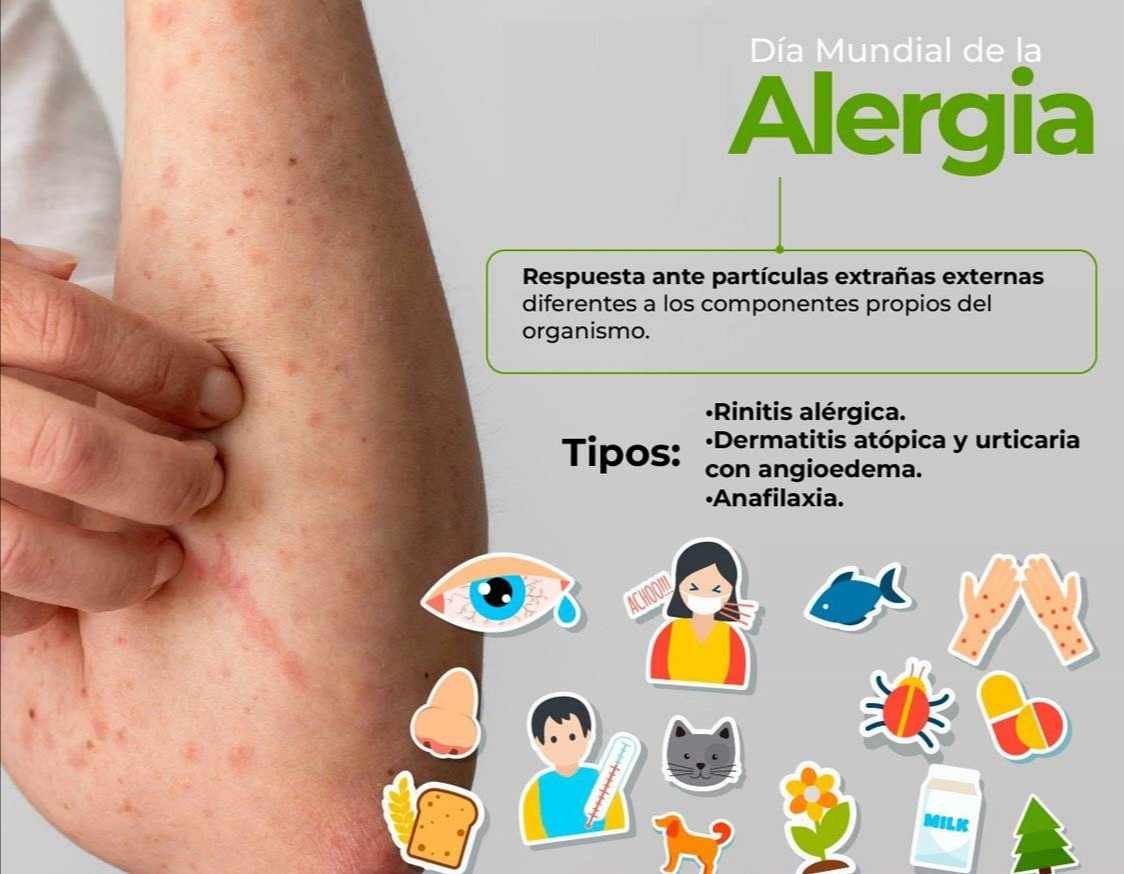 EXHORTA IMSS A CORRECTO CUIDADO DE ALERGIAS