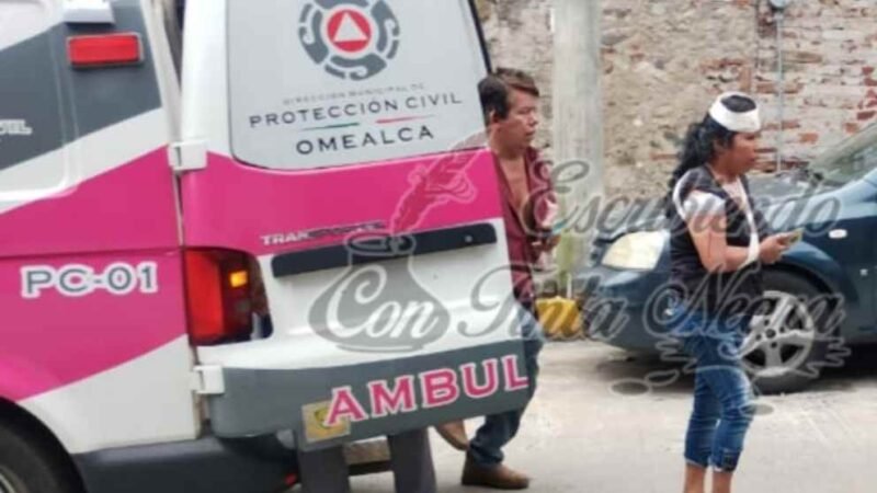 BALEAN A MUJER EN ASALTO