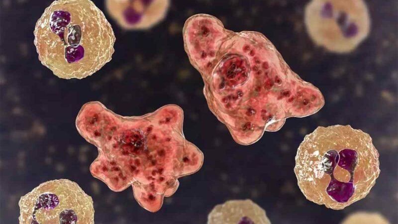BACTERIA “COME CEREBROS” MATA A OTRA PERSONA EN TEXAS