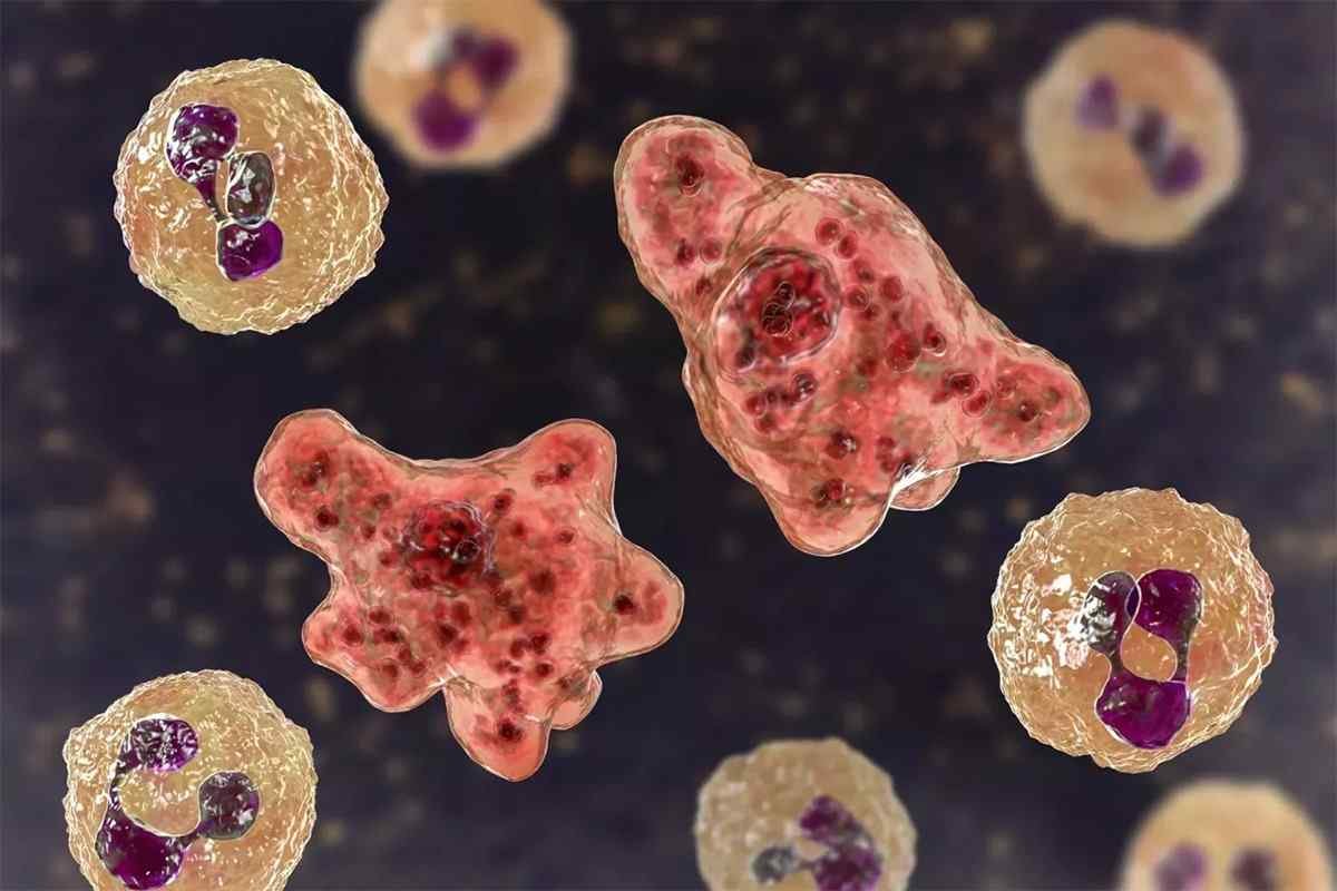 BACTERIA “COME CEREBROS” MATA A OTRA PERSONA EN TEXAS