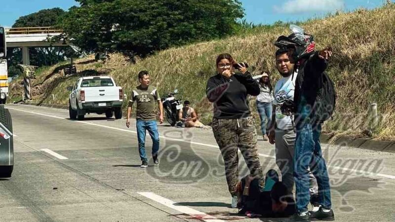 MUJER PIERDE UNA PIERNA EN ACCIDENTE DE MOTO