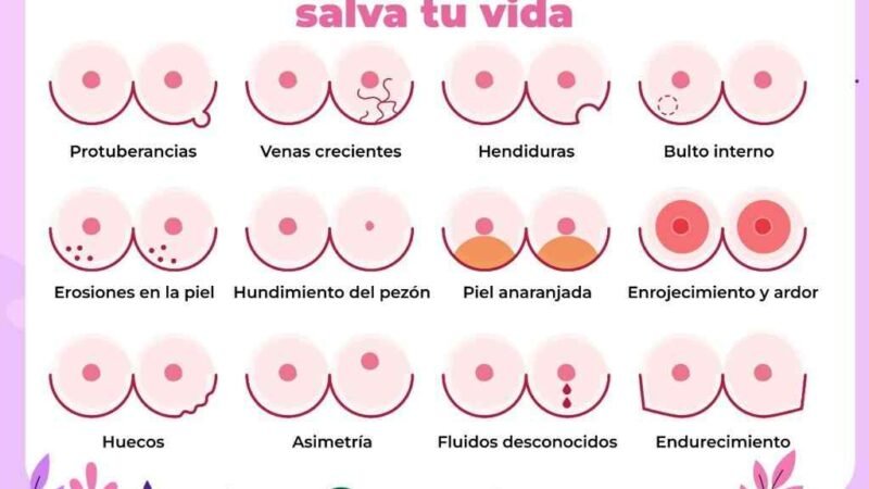 RECOMIENDA IMSS AUTOEXPLORACIÓN PARA PREVENIR CÁNCER DE MAMA