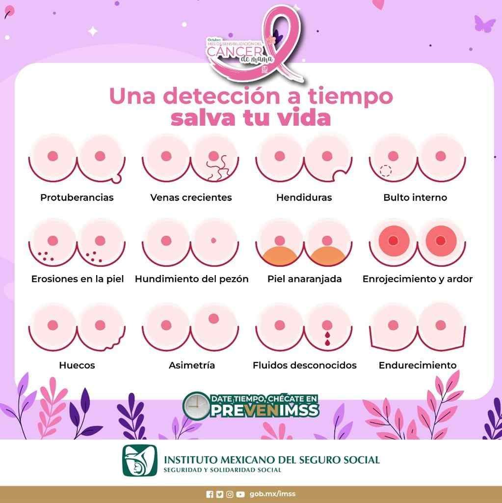 RECOMIENDA IMSS AUTOEXPLORACIÓN PARA PREVENIR CÁNCER DE MAMA