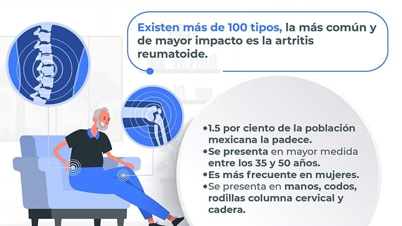 MUJERES MAYORES, MAS PROPENSAS A PADECER ARTRITIS REUMATOIDE