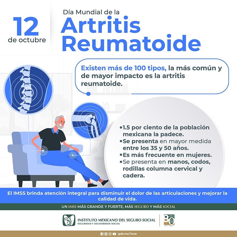 MUJERES MAYORES, MAS PROPENSAS A PADECER ARTRITIS REUMATOIDE