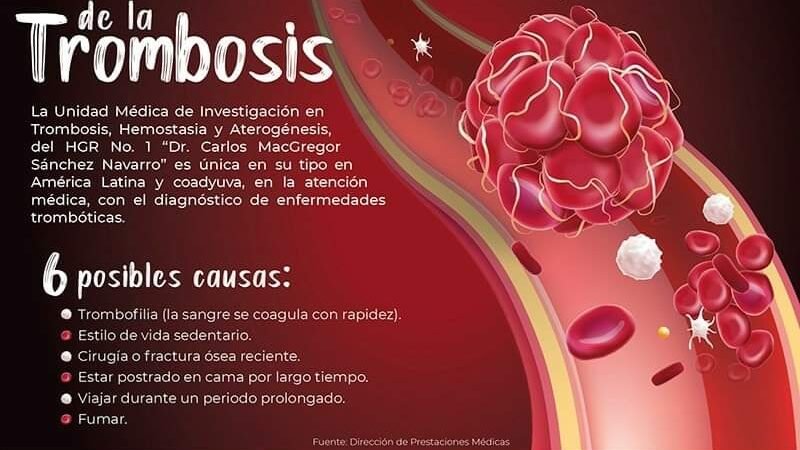 INFORMA IMSS SOBRE SÍNTOMAS DE TROMBOSIS
