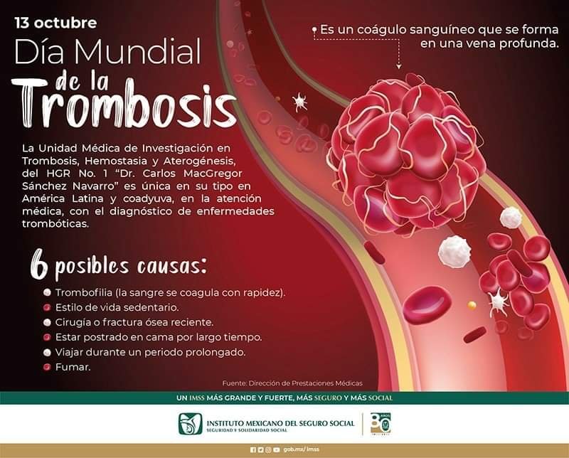 INFORMA IMSS SOBRE SÍNTOMAS DE TROMBOSIS