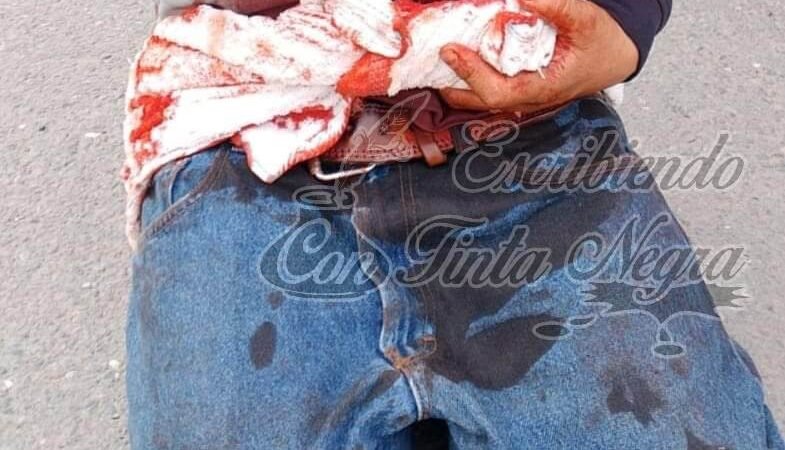 BALEAN A JOVEN; MURIÓ EN EL HOSPITAL